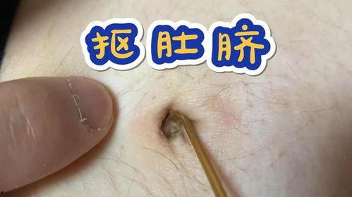 肚脐清理视频,告别污垢困扰