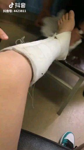 石膏腿视频,挑战与成长的见证