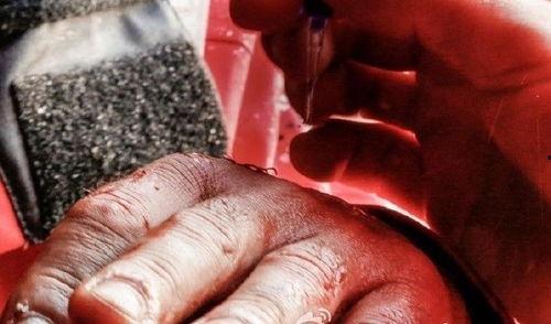 伤口缝合视频,视频教学带你轻松掌握