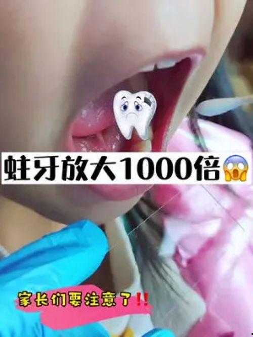 不刷牙视频,口腔健康大揭秘