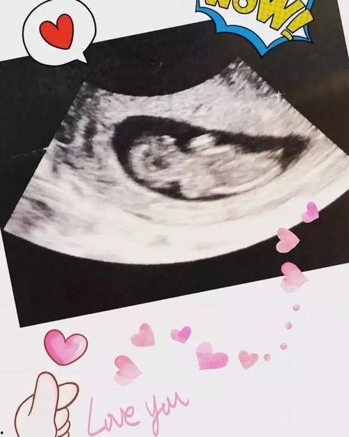 胎儿胎动视频,胎儿胎动视频背后的温馨瞬间