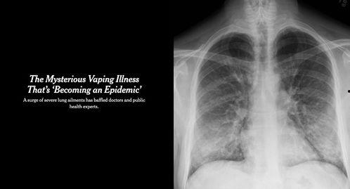 肺炎视频,症状、预防与治疗全解析